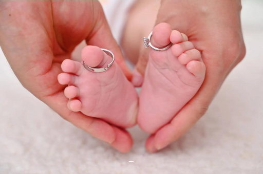 顺德孕妇怎样预防妊娠纹 顺德孕妇怎样预防妊娠纹